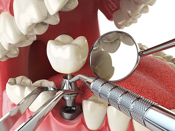 Best Emergency Root Canal Therapy in Calico Rock, AR