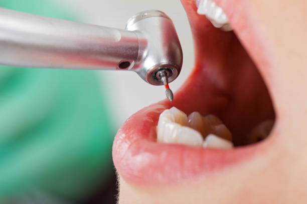 Best Emergency Denture Repair in Calico Rock, AR